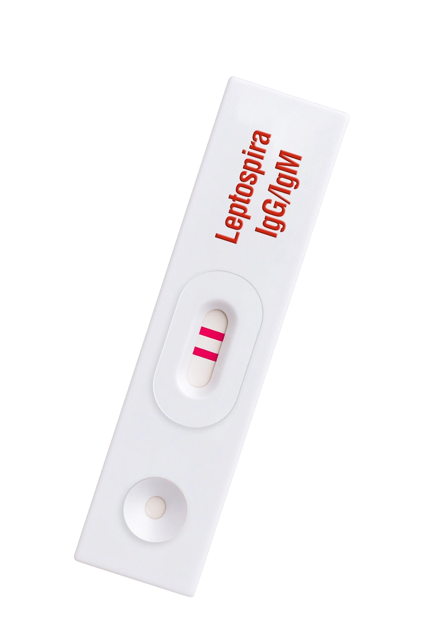Leptospira IgG/IgM